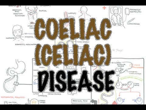 Coeliac (Celiac) Disease – Overview (signs and symptoms, pathophysiology, diagnosis, treatment)