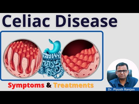 Celiac Disease (Wheat Allergy) : Symptoms, Causes, Diagnoses, Risk Factors & Treatments (हिंदी)