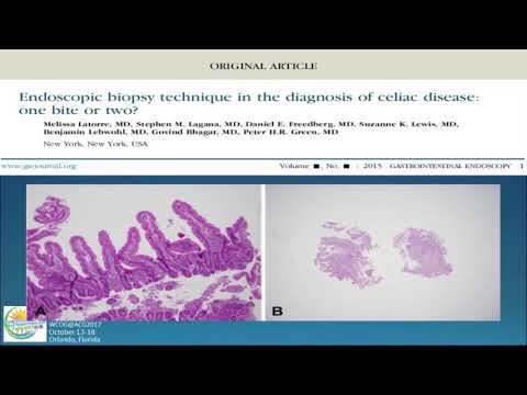 Celiac Disease: Novel Therapeutic Approaches Beyond Gluten Withdrawal